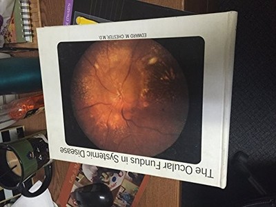 OCULAR FUNDUS IN SYSTEMIC DISEASE: A CLINICAL PATHOLOGICAL By E M Chester *VG+*