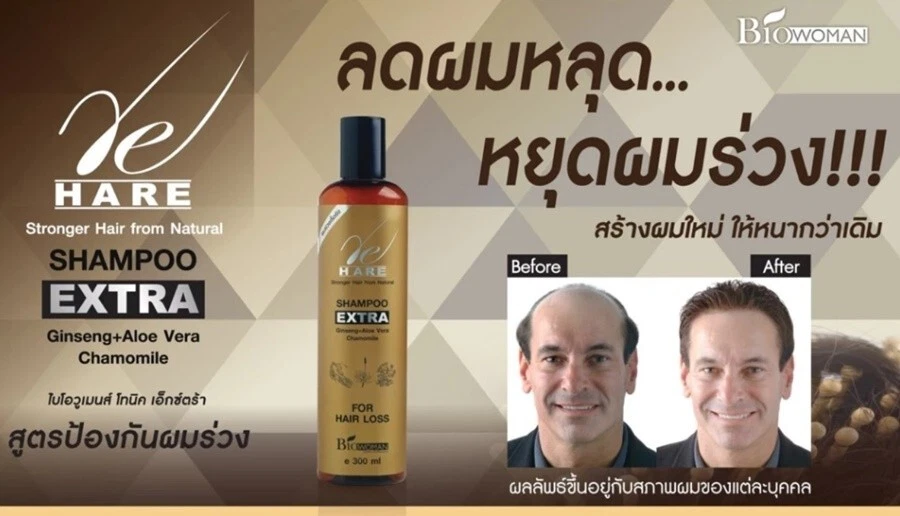 5 x 300 ml. Biowoman Herbal Shampoo Extra Natural Anti Hair Loss Treatment - Image 4 of 4