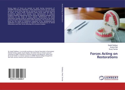 Forces Acting on Restorations Sadaf Siddiqui (u. a.) Taschenbuch 152 S. Englisch