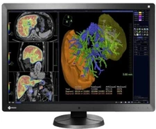 Eizo RadiForce RX650 6MP 30" Color LED General Radiology PACS Monitor (RX650)