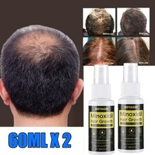 2X Topical Minoxidil 5 Spray for Hair Regrowth Treatment for Men 2 Month Supply