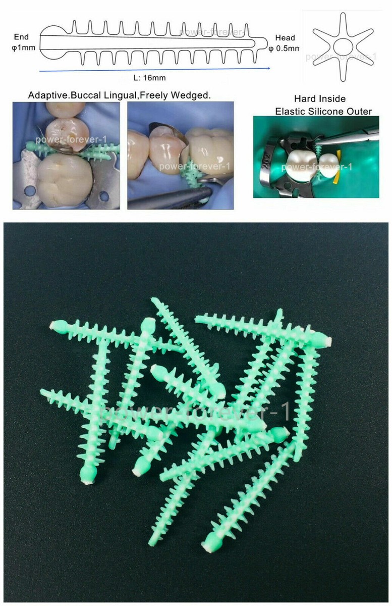 40Pcs Dental Adpative Wedges Matrix 134℃ Carpenterworm Diastema