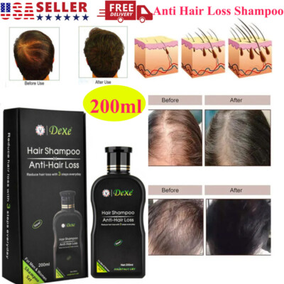 Dexe Original Anti Hair Loss Shampoo Natural Herbal Hair Growth Treatment 200ml