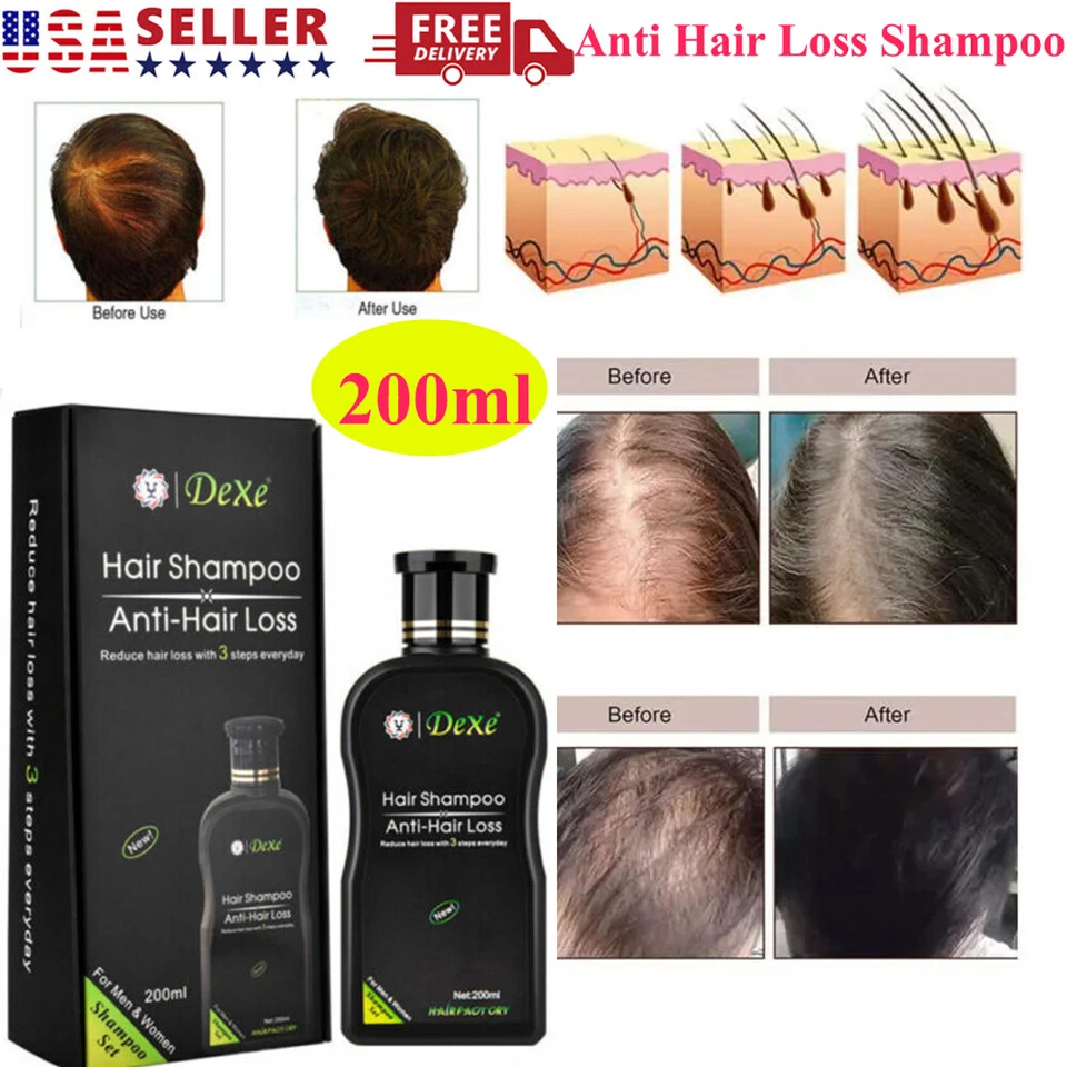Hair Growth Shampoo Hair Regrowth Treatment Anti-Hair Loss Shampoo For Men&Women - Image 3 of 4