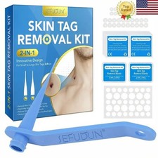 Auto Micro Skin Tag Remover Device Kit Safe Painless Removal 2-8 mm Band Tool