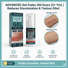 Set of 2 Gel Fades Old Scars 5 Yrs Reduces Discoloration Texture 50ml