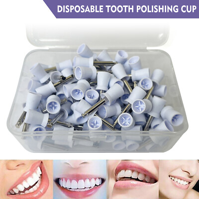 500-Pack Dental Latch-Type Polishing Cups & Prophy Brushes - White, For Tooth Cleaning