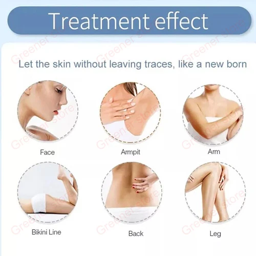 2IN1 Ice Titanium 755nm 808nm 1064nm Diode Laser Full Body Hair Removal Machine - Picture 10 of 13