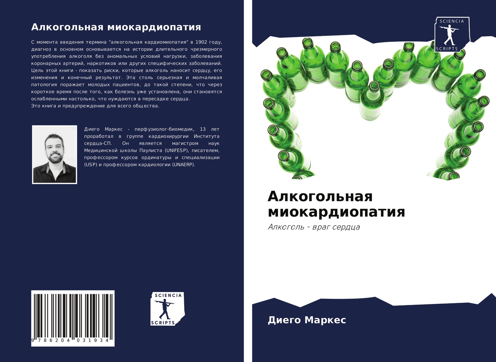 Alkogol'naq Miokardiopatiq Alkogol' - Wrag Serdca Diego Markes