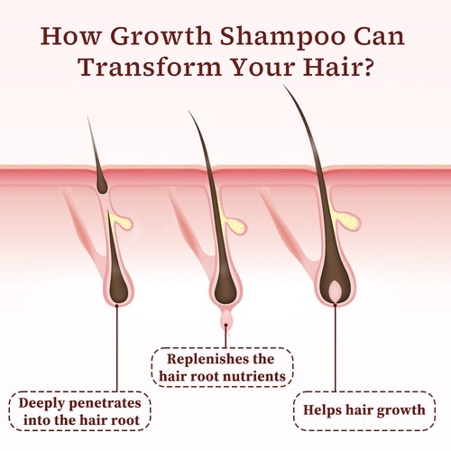 Fast Hair Growth Shampoo hair regrowth treatment For Women&Men - Picture 7 of 8