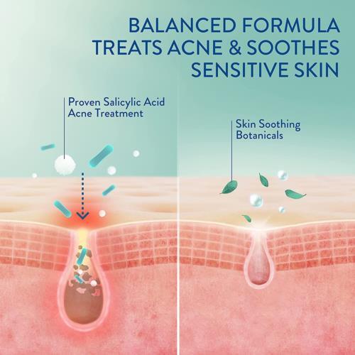 Cetaphil Acne Face Wash, Gentle Clear Clarifying Cream Cleanser with 2%... - Picture 3 of 8