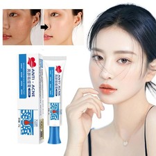 25g Acne Cream Herbal Hydrating Moisturizing Acne Cream Fades Acne Marks