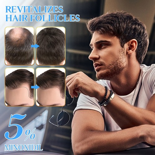 Haarwuchs Spray Serum Schnelles Haarwachstum Flüssige Anti Haarausfall Spray DE - Bild 3 von 14