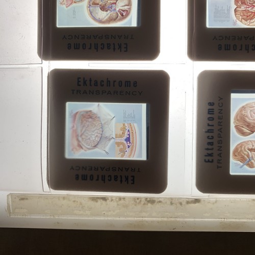 Vintage Medical Slides - Picture 19 of 19