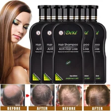 200ML DEXE Anti-Hair Loss Shampoo Natural Herbal Hair Regrowth for Men & Women