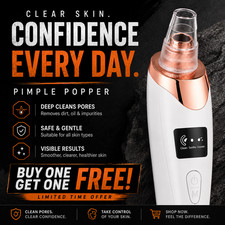 Pimple Blackhead Remover Cleaner Face Pore Vacuum Suction White Heads