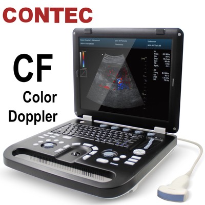 Color Doppler Ultrasound Scanner Portable Laptop Machine Color Diagnostic Convex