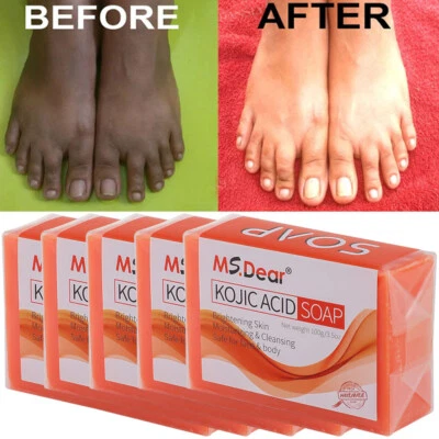 MS.DEAR Kojic Acid Soap Facial Cleaning Dark Spot Acne Remover Body Skin Lightening Soap