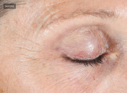 (NEW) iS CLINICAL - Active Peel System (6 sets) - Picture 3 of 4