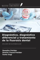Deepika Patidar (U. A.) | DiagnóStico, DiagnóStico Diferencial Y Tratamiento...