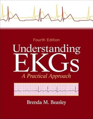 Understanding EKGs: A Practical Approach