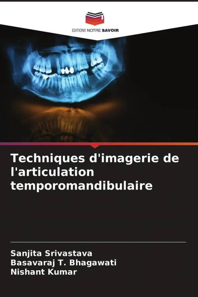 Techniques D'imagerie De L'articulation Temporomandibulaire Srivastava (U. A.)-image