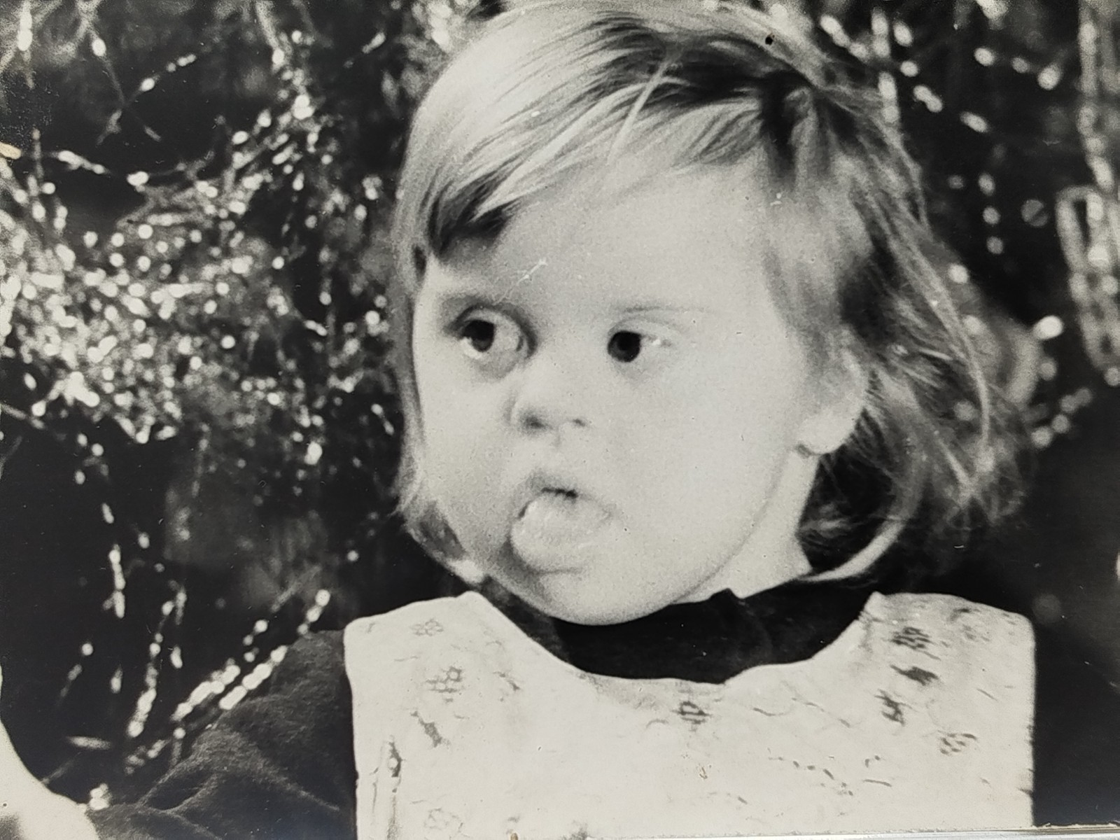 Vintage Photo - Little Girl With Down's Syndrome #75