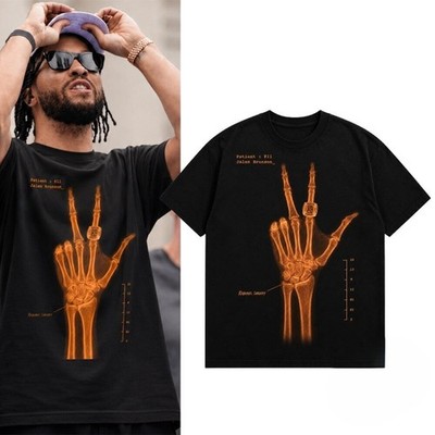 NEW ITEM HOT Jalen Brunson Wrist Surgery X-Ray Graphic Shirt Basketball Fan Tee