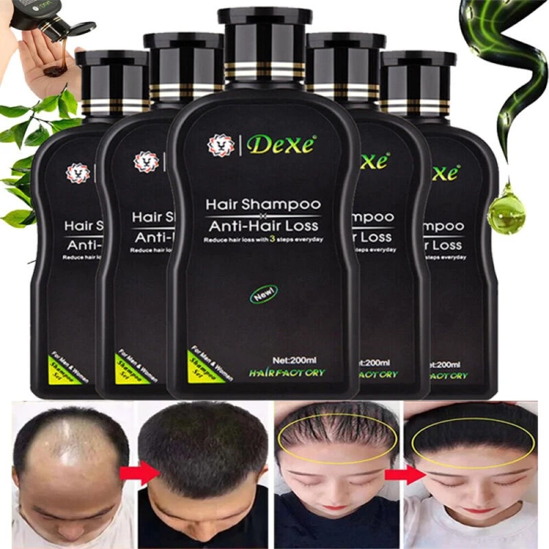 Fast Hair Growth Shampoo For Women Men Anti Hair Loss Treatment Care Thickening~ - Image 3 of 4