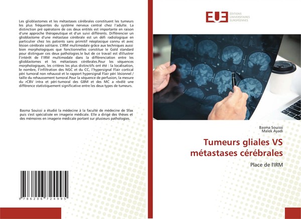 Basma Souissi (U. A.) | Tumeurs Gliales VS MéTastases CéRéBrales | Taschenbuch-image