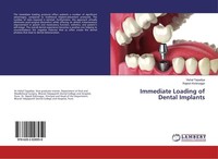 Immediate Loading Of Dental Implants Rajesh Kshirsagar