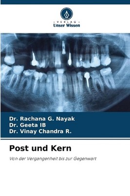 Post und Kern by Dr Rachana G. Nayak (German) Paperback Book
