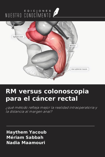 Rm Versus Colonoscopia Para El CáNcer Rectal Nadia Maamouri-image