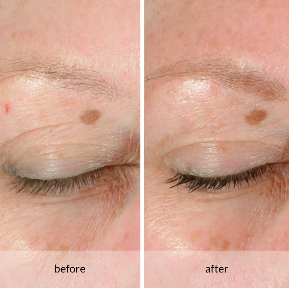 Sistema de doble ojo Avon Anew Lifting con Protinol 20 ml / 0,66 fl oz *NUEVO* Foto 4 de 4