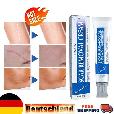 SCAR REMOVAL CREAM SkinRepair Scar Remover丨Acne Treatment丨FadeStretchMark 30g