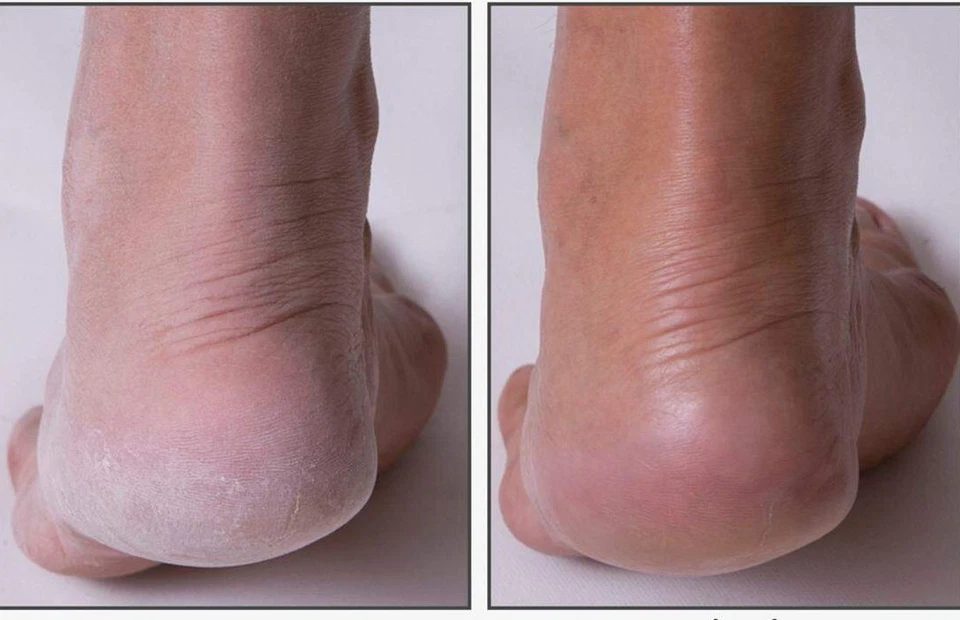 Wei East каштановое/черное соевое укрепляющее контурное взбитое масло для тела 5,07 унц - Изображение 3 из 4