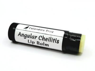Angular Cheilitis Lip Balm - BEST SELLER!!