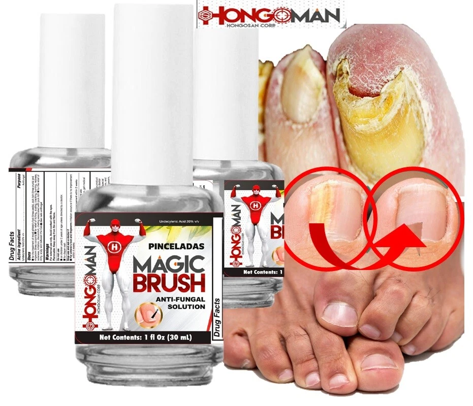 Discover more than 148 antifungal nail liquid best ceg.edu.vn
