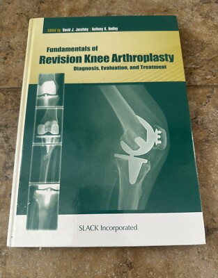 Fundamentals of Revision Knee Arthroplasty : Diagnosis, Evaluation, and Treat...