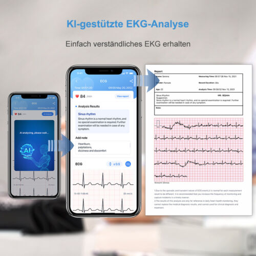 DuoEK-S Mobiles EKG Gerät, Bluetooth Tragbarer Herzmonitor KI-Analyse über App - Bild 4 von 12