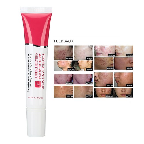 TYJR Scar Removal Cream Face Body Repair Gel Skin Repair Dark Spot Cream 15 AU - Picture 11 of 12