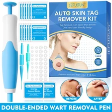 Electric Laser Plasma Mole Removal Pen Dark Spot Remove Skin Wart Tag Tattoo LCD