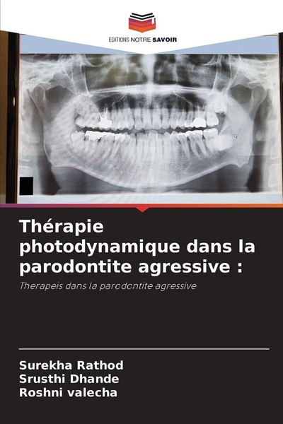 ThéRapie Photodynamique Dans La Parodontite Agressive : | Surekha Rathod (U. A.)-image