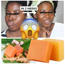 3/2Pcs Turmeric Soap Dark Spots Acne Face & Body Wash Brightening Bleaching Soap
