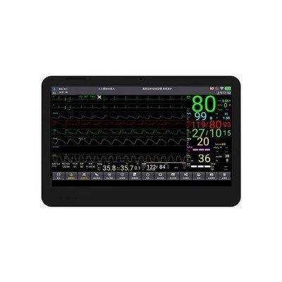 14 inch touch screen ICU monitor - multi parameter patient vital signs+printer