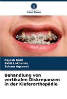Behandlung Von Vertikalen Diskrepanzen In Der KieferorthopäDie Akhil Lokhande