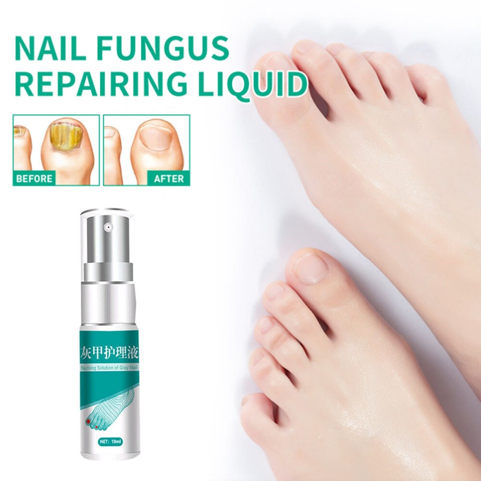 1pc 10ml Herbaceous Nail Treatment Essence Toenail Damaged Repair Fluid