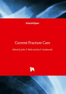 John Riehl (u. a.) | Current Fracture Care | Buch | Englisch (2024) | IntechOpen