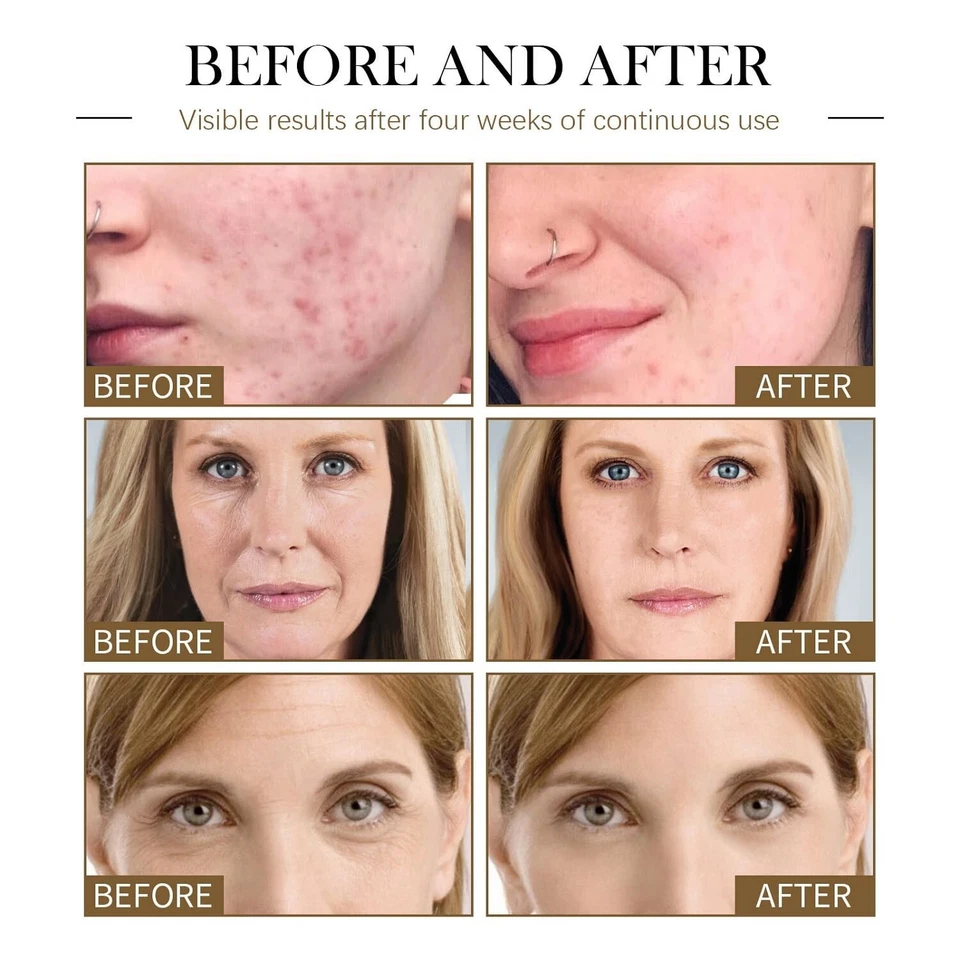 3 PIEZAS Aceite de Lalenas para Rostro, Aceite de Ricino Lalena Aceite de Semilla Negra Aceite de Rosa Mosqueta Seru Facial Foto 4 de 4