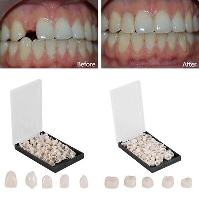 NEWLY Temporary Teeth Crowns Posteriors Anterior Molar Resin Tooth Caps Dental